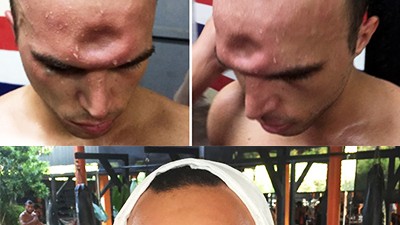 Травма головы Джереми 